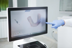 iTero Digital Dental Scanner & Imager available at Kam Dental Baytown in Baytown, TX